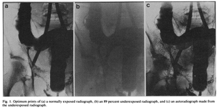 Illustration for article titled This Chemist Discovered How to Salvage Useless Photos with a Dash of Radioactivity